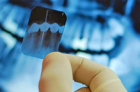 imagen Endodoncia